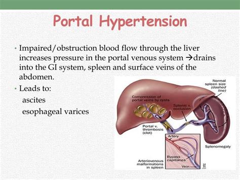 Many conditions are associated with portal hypertension, with cirrhosis being the most common cause of this disorder. PPT - HEPATIC DISORDERS PowerPoint Presentation - ID:2405873