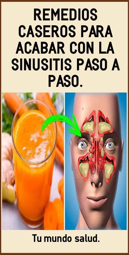 Remedios Caseros Para Acabar Con La Sinusitis Paso A Paso