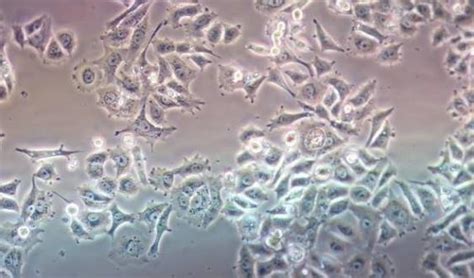 Common Contamination And Solutions In Cell Culturescell Culture