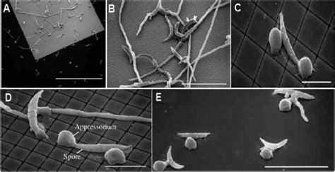 Scanning Electron Micrographs Sem Showing The Fungus Colletotrichum