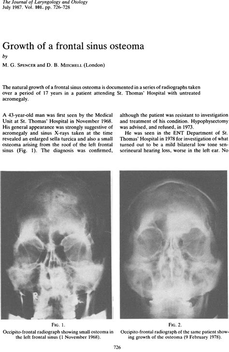 Growth Of A Frontal Sinus Osteoma The Journal Of Laryngology
