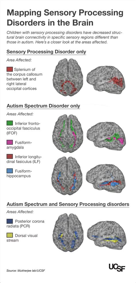 Kids With Autism Sensory Processing Disorders Show Brain Wiring
