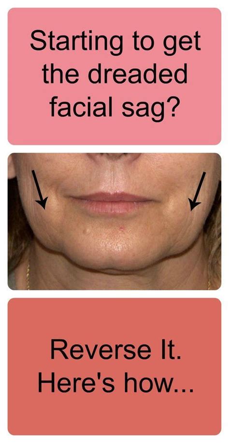 How To Reverse Facial Sagging Facial Exercises Facial Muscles Skin