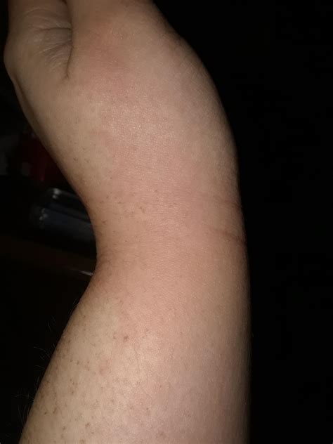 What Could My Rash Have Been Askdocs