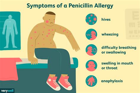 Аллергия На Пенициллин Отзывы Telegraph