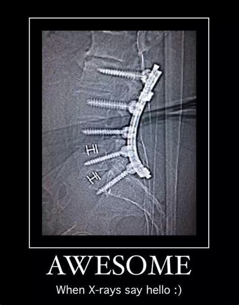 Radiology Xray Humor Radiology Humor Radiology Diagnostic Imaging