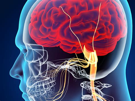 What Are Functional Neurological Disorders Plasticity® Centers