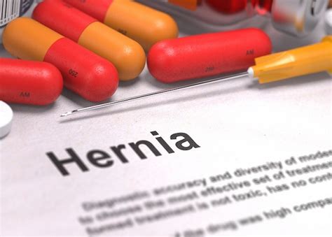 All You Need To Know About Your Hernia Surgery