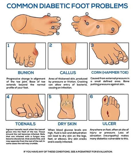diabetes and related foot complications