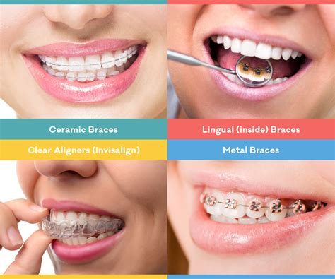 With traditional braces, we use several components and tools to straighten your teeth:. Can I straighten my teeth without braces? - Australian ...