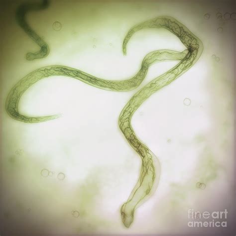 Hookworms Photograph By Science Picture Co Fine Art America