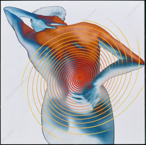 Abstract Artwork Depicting Lower Back Pain Stock Image M3820271
