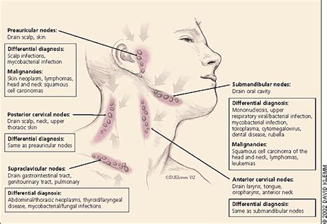 Posterior Cervical Lymph Nodes Swollen Causes