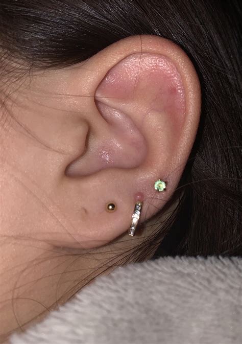 Help My Lobe Piercing Suddenly Has A Bump Above It Ive Had This Piercing For Months With No