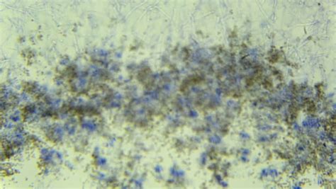 A, c, d, i, i, n, o. Penicillin Under The Microscope, (Penicillium W.M). Full ...
