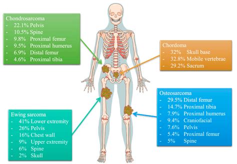 Cancers Free Full Text Recent Advances In The Treatment Of Bone