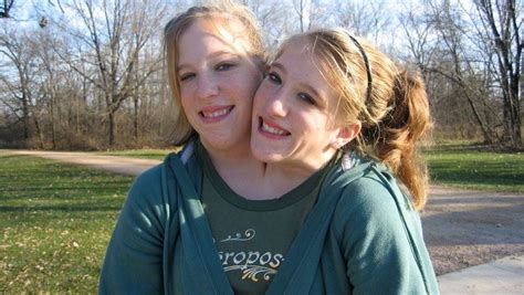 rare conjoined twins abby and brittany share their exciting news with the world