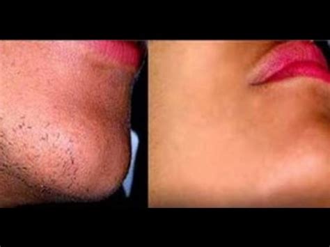 Why do girls remove facial hair? Home Remedies to Remove Facial Hair Permanently - YouTube