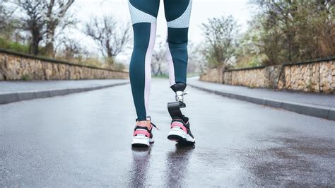 How To Learn To Walk With A Prosthetic Leg