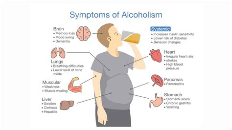Understanding Alcoholic Brain Damage Miracles Asia