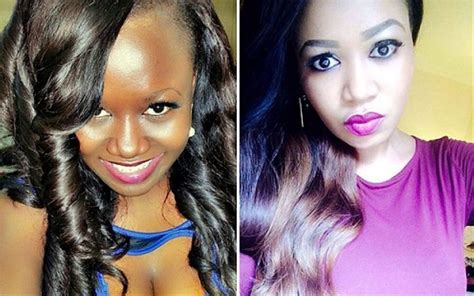 5 Things You Should Know Before Bleaching Your Skin