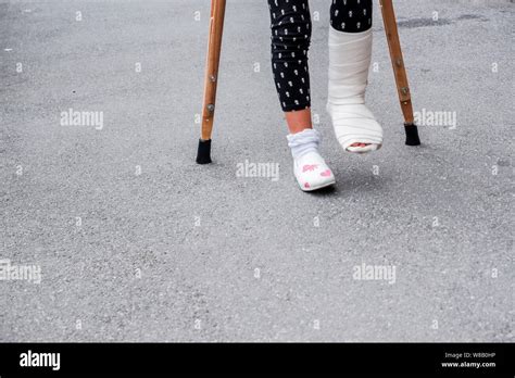 Leg Cast Crutches High Resolution Stock Photography And Images Alamy