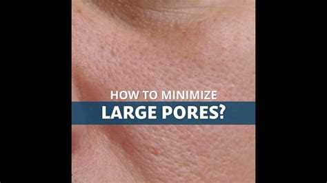 Is It Possible To Shrink Large Pores Youtube