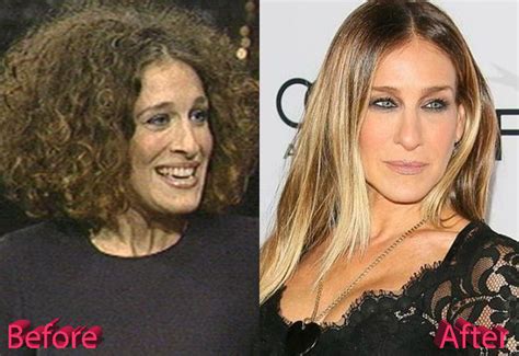 Sarah Jessica Parker Nose Job : Just a Gossip?