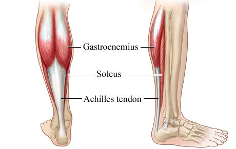 The tendon is formed from the gastrocnemius and soleus muscles. Achilles Tendinosis - Causes and Treatment | Bone and Spine