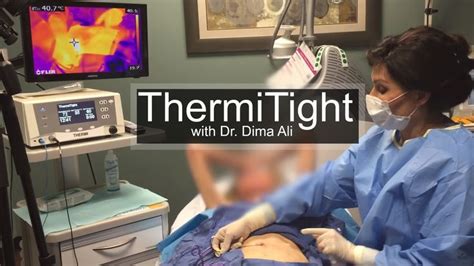 Dr Dima Is Bringing You Along As She Performs A Thermitight Procedure