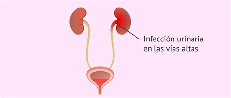 Infecciones Urinaria Guadalajara Infecciones Urinarias Síntomas y Causas Ginecología