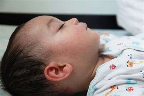 What Causes Babies To Have Seizures Infant Seizures Birth Injury