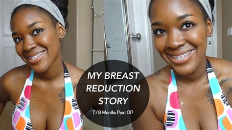 Breast Reduction 7 Month Post Op Scars And Pain Youtube