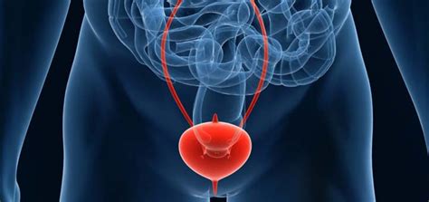 Accurate Education, CAM - Interstitial Cystitis
