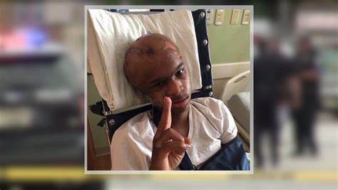 It Was A Miracle Teen Survives Being Shot In Head Recovers From Brain Surgery