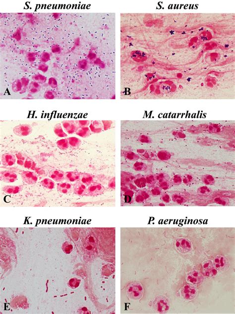 Bacterial Morphotypes In Sputum Gram Stain ×100 Oil Immersion Field