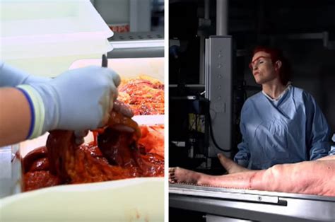 Bbc Three To Shock With Human Autopsy On Obesity The Post Mortem