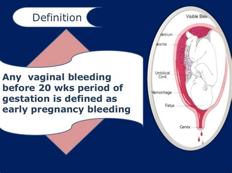 How To Approch A Case Of Bleeding In Early Pregnancy With Case Illust