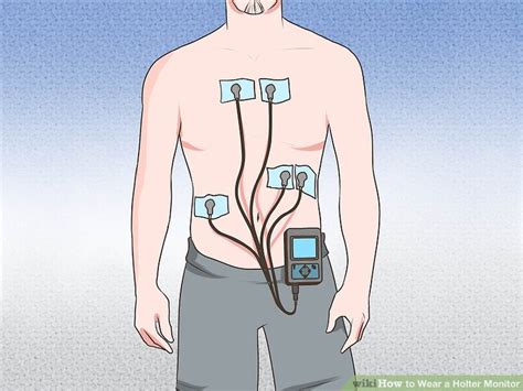 Holter Monitor 5 Lead Placement Diagram Diagram For You