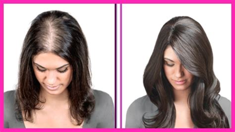 Like so many women—about 70%, in fact—our family each experienced different situations that drove us toward our desire of wanting to enhance our thin hair: She Had Very Thin Hair But She Used This Ingredient And ...