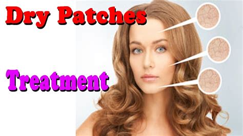 Dry Patches On Face How To Deal With Dry Patches On The Face Dry