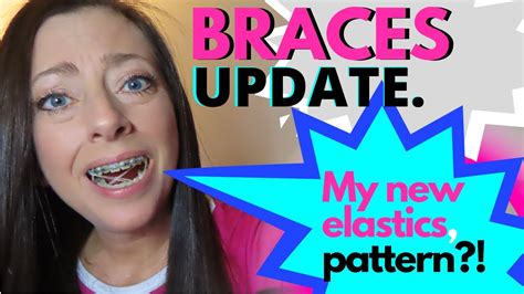 How To Put Wax On My Braces My Braces Routine 🇲🇾 Youtube Good News With Time Your Cheeks