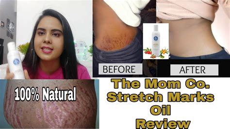 The Moms Co New Stretch Marks Natural Stretch Oil Youtube