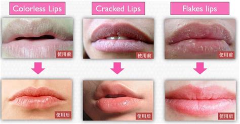 Star To Lip Hydrogel Lip Patch Tradekorea