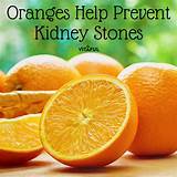 Holistic Cure For Kidney Stones Pictures