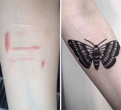 Amazing Tattoos That Turn Scars Into Works Of Art