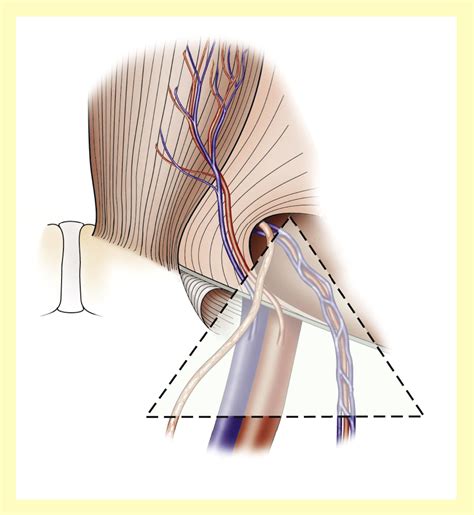 Hernia Symptoms Male Groin Laparoscopic Inguinal Hernia Surgery India