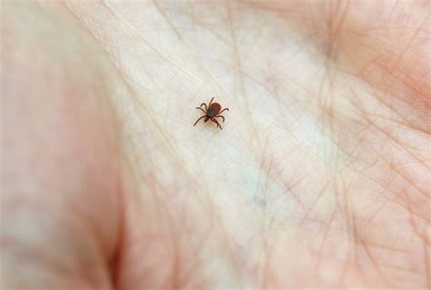 Did You Get Bit By A Lyme Infested Tick Heres What To Do Wbur News