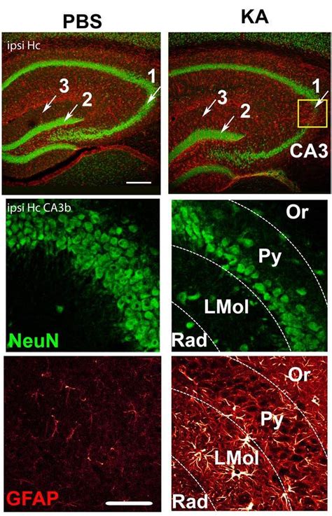 Ipsilateral is used in medical, anatomy. Histology of the ipsilateral hippocampus using NeuN and ...