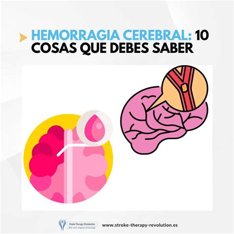 Hemorragia Cerebral Causas S Ntomas Y Tratamiento